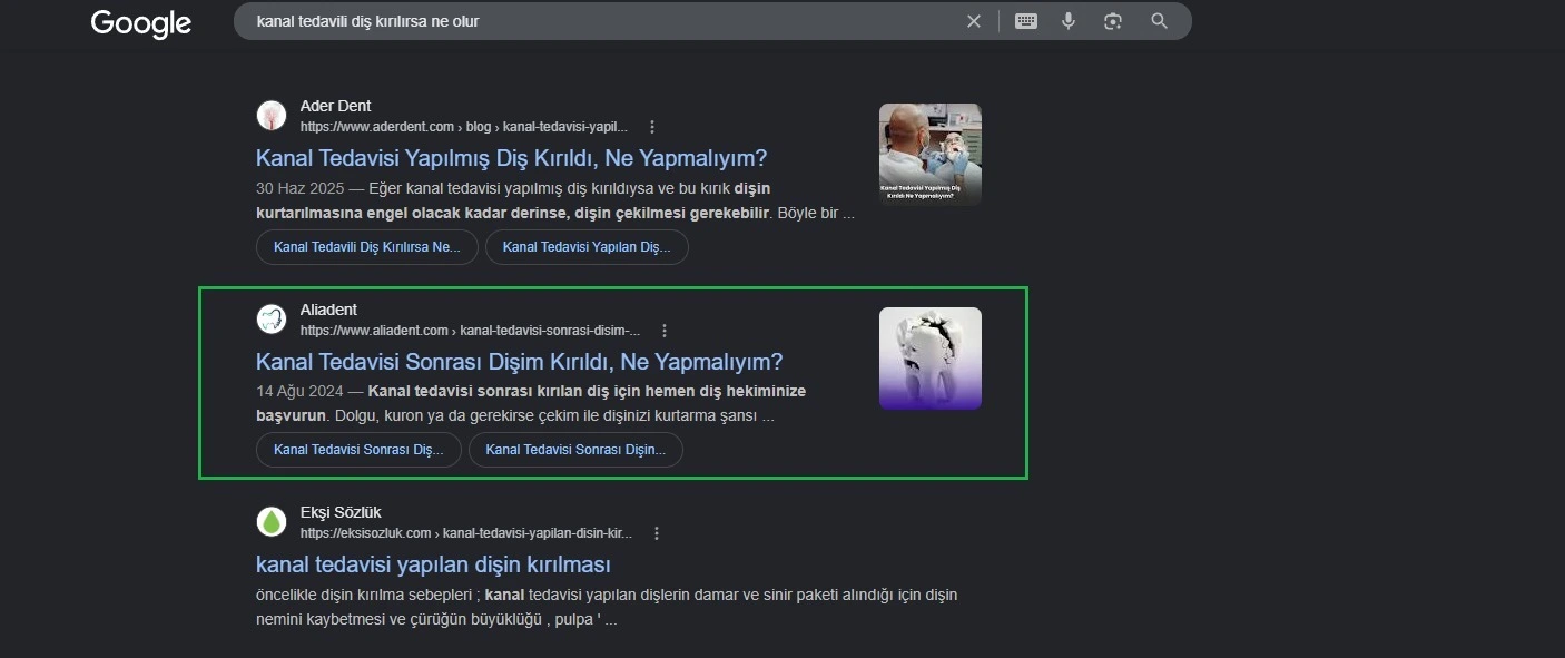 Yerel İşletmeler SEO